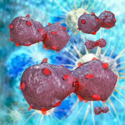 Checkpoint Inhibitors in Immunotherapy Show Promise for Lung Cancer