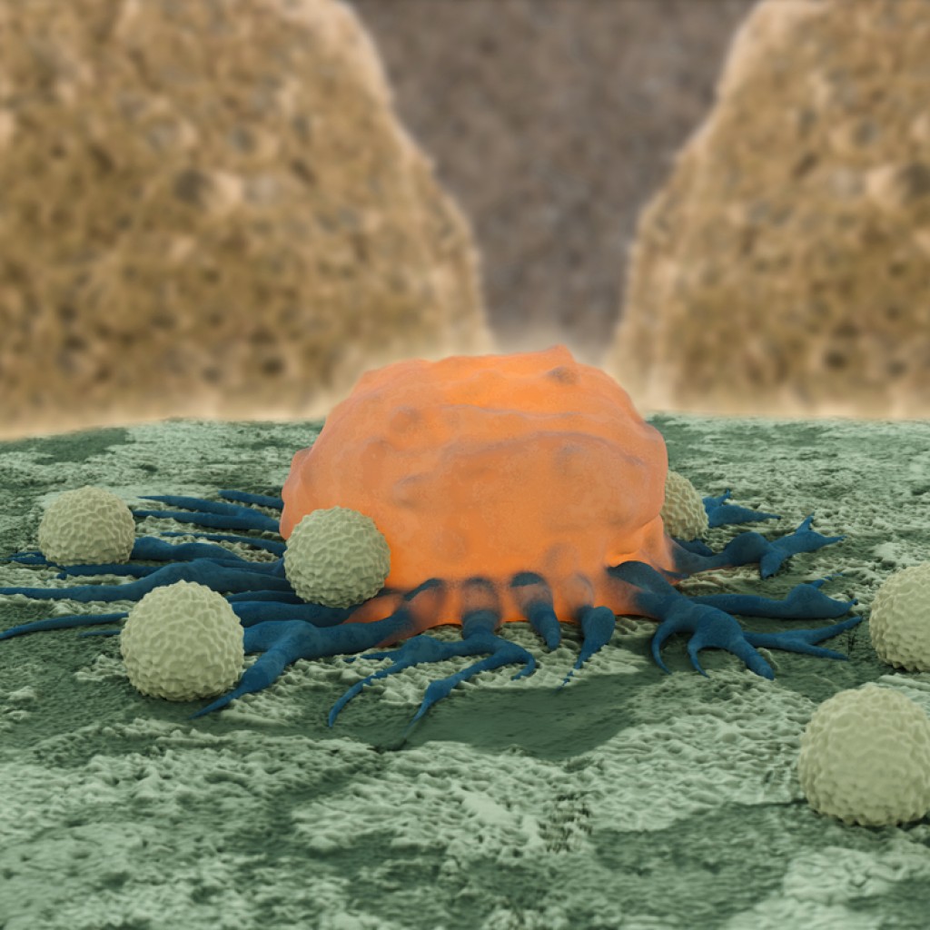 HER2-specific T cells As An Immunotherapy In HER2-Positive Sarcoma