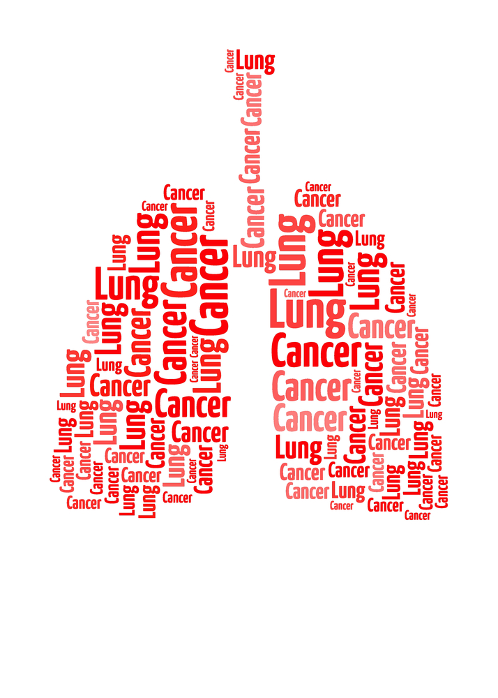 Pembrolizumab, a PD-1 inhibitor, Revealed as Promising Therapy for Malignant Pleural Mesothelioma