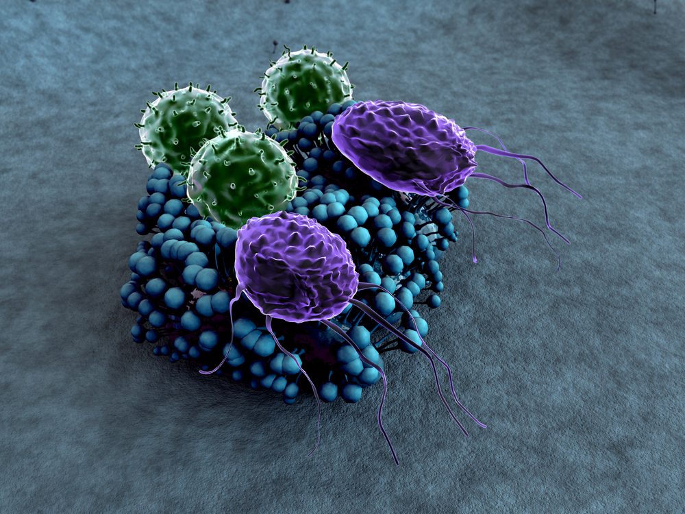 Foreign Antibodies Stimulate Immune System Against Cancer