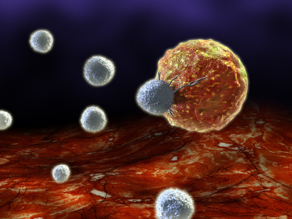 Lymphoma Escapes Immune Responses Via NKG2D Receptor Down-Regulation
