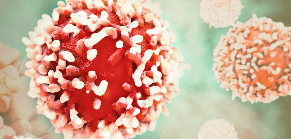 Radiotherapy Booster NBTXR3 Can Trigger Anti-Tumor Immune Responses, Studies Suggest