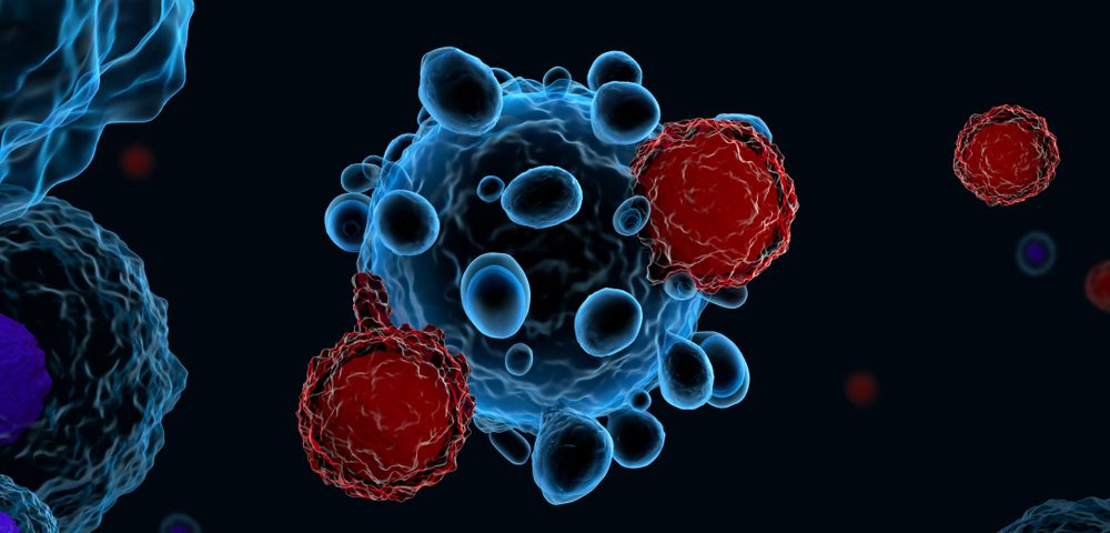 Subtypes of Immune Cells in Tumor Environment Can Predict Follicular Lymphoma Response to Therapy